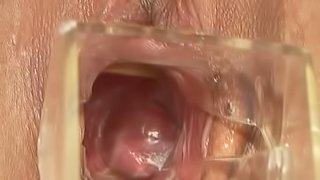 Mela lets some guy in rubber gloves play with her wet pussy